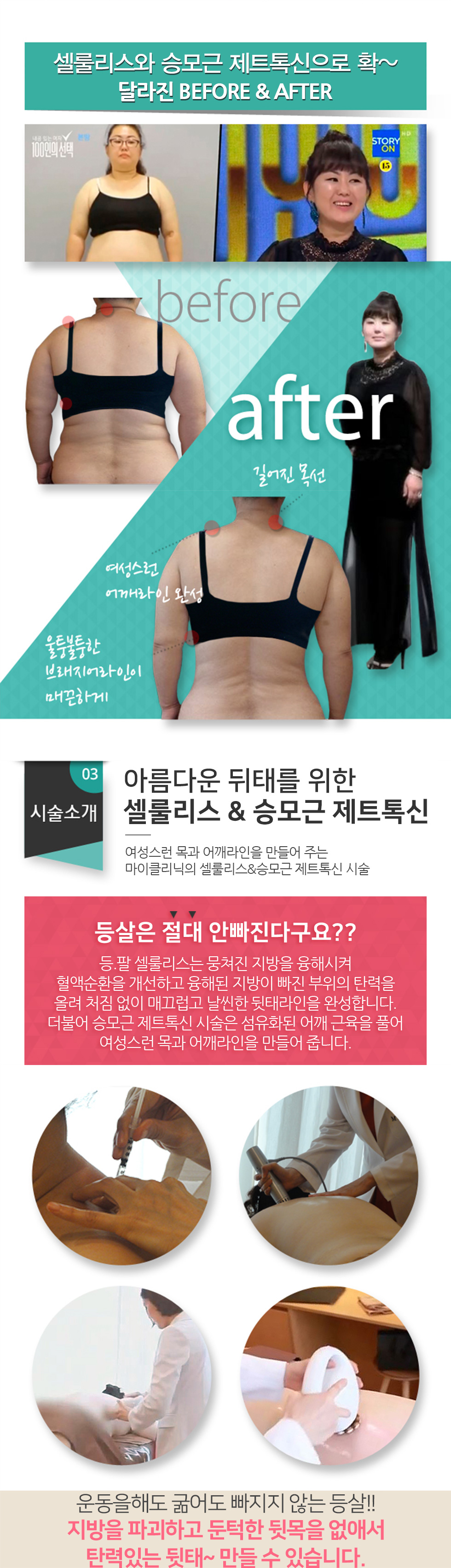 새롭게 태어난 그녀의 뒷태