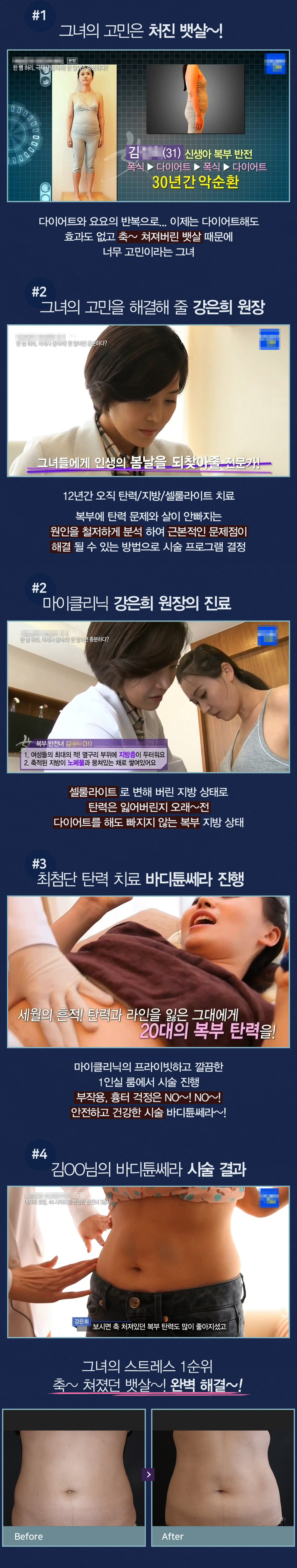 바디탄력 바디튠쎄라