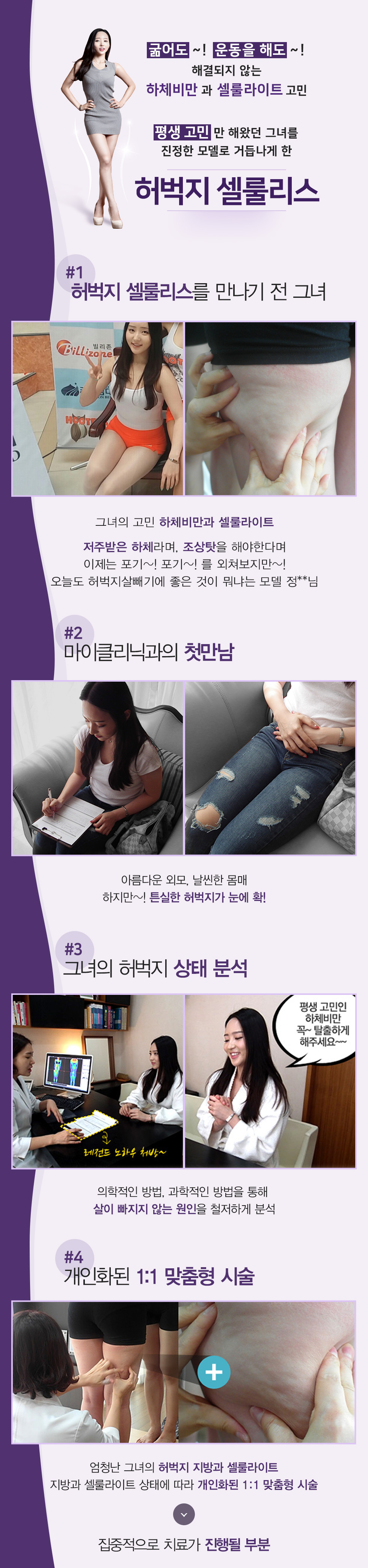 허벅지 셀룰리스 03