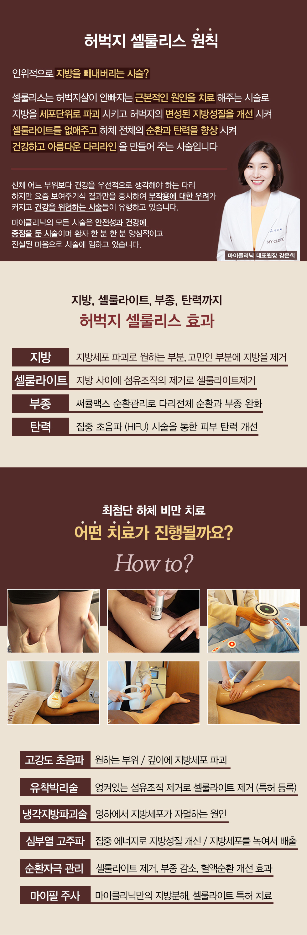 허벅지 셀룰리스 05