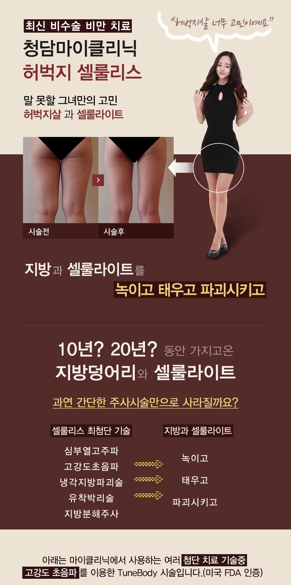 허벅지 셀룰리스 01