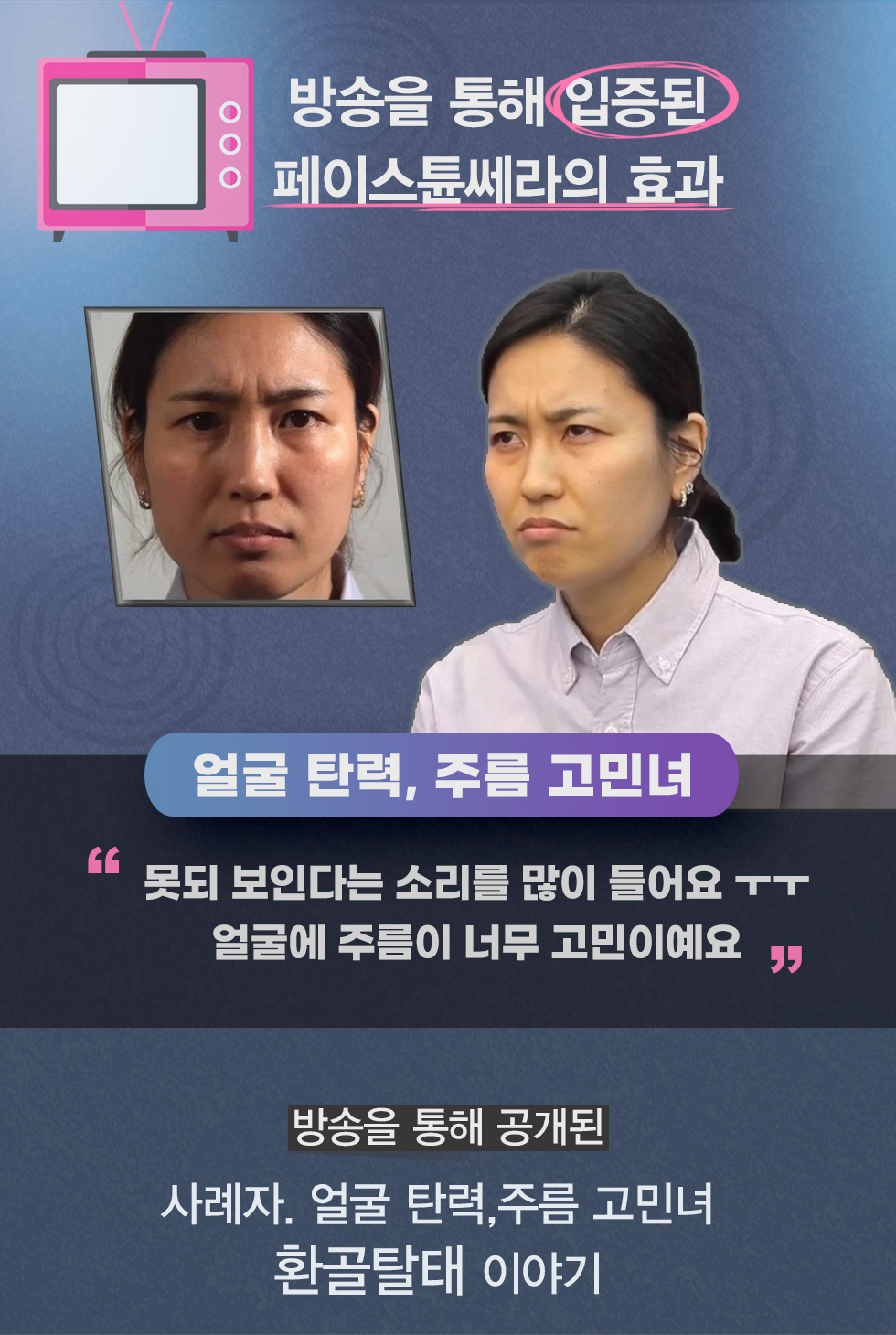 얼굴탄력 페이스튠쎄라