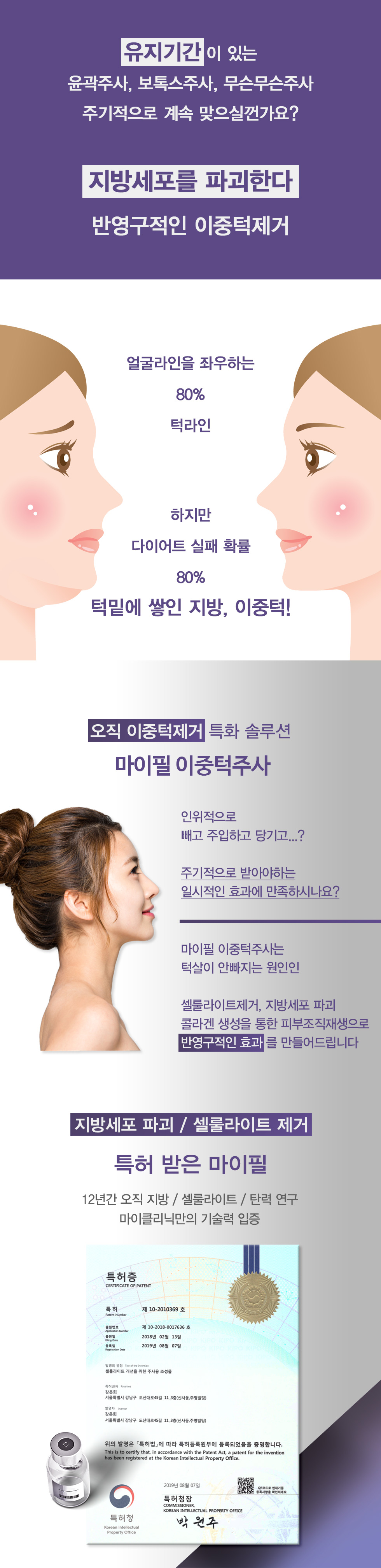 이중턱제거 마이필 이중턱주사 01