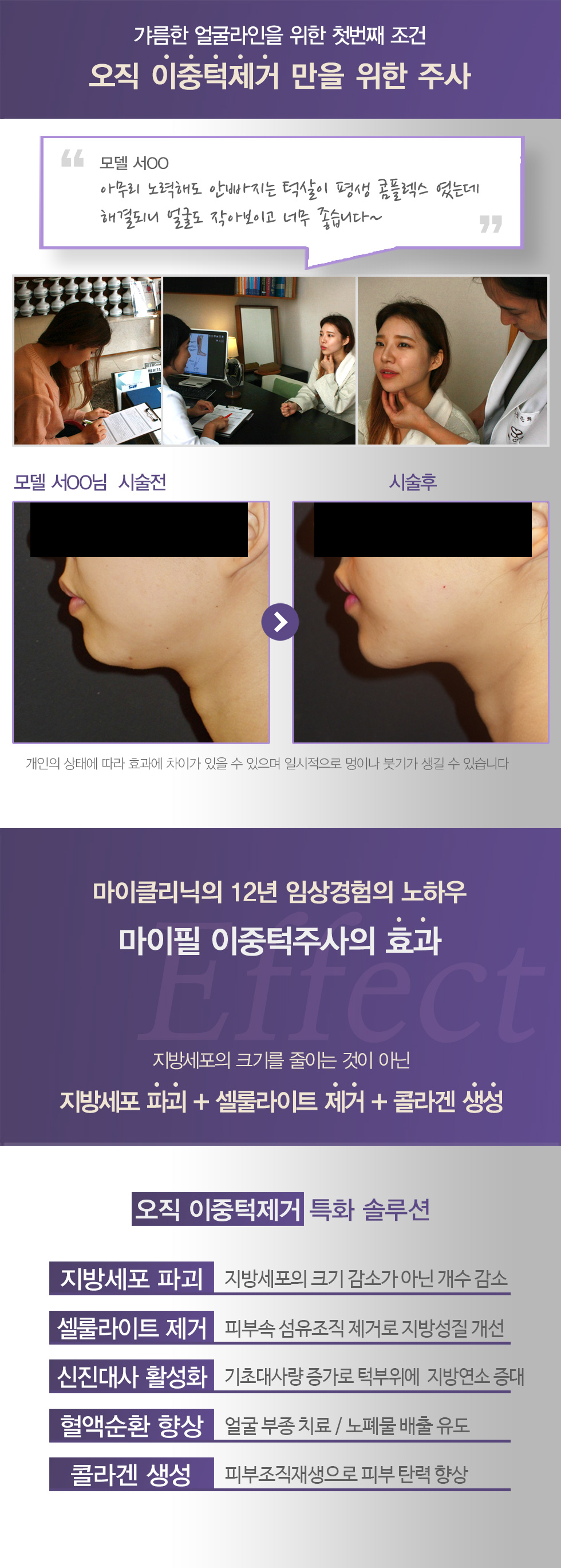 이중턱제거 마이필 이중턱주사 02