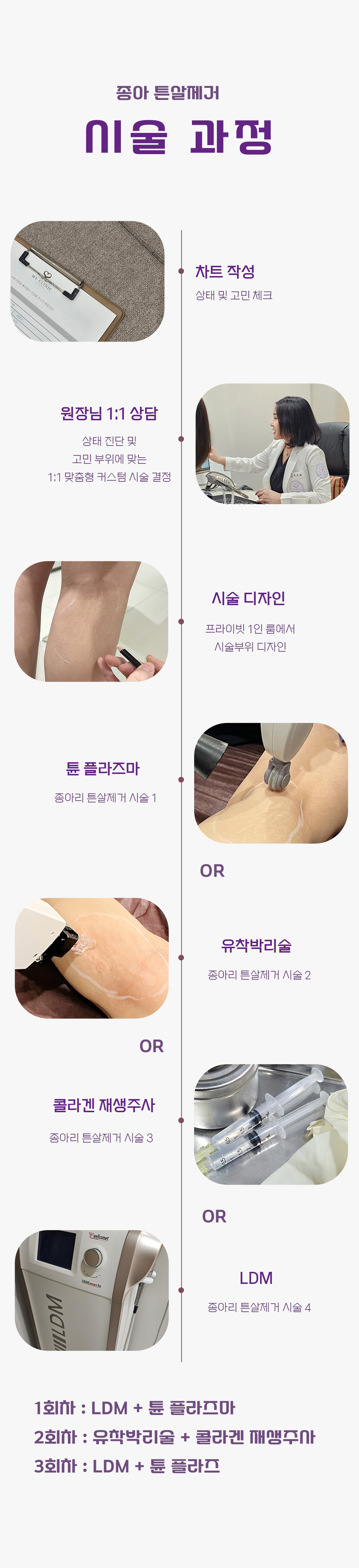 종아리 튼살제거 3
