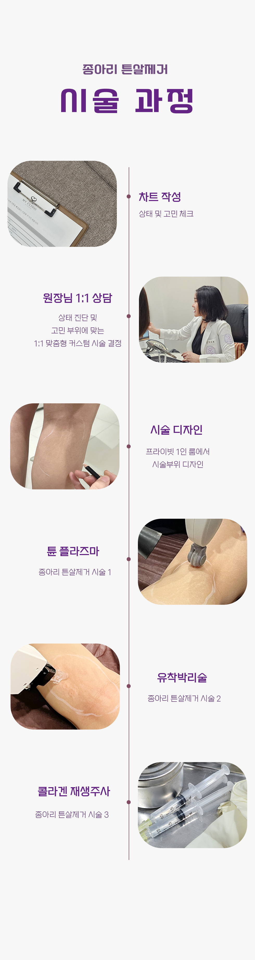 종아리 튼살제거 5