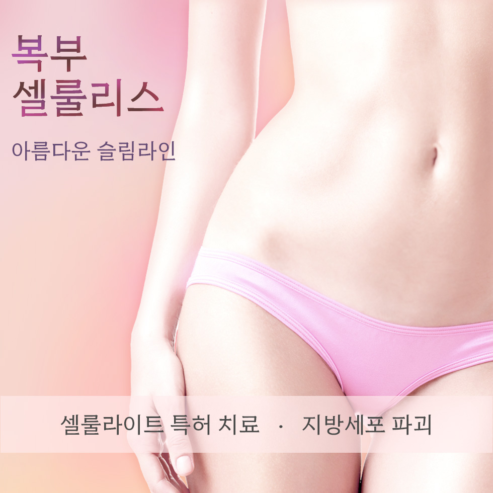 복부 셀룰리스